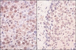 SMCHD1 Antibody, Novus Biologicals 0.1mL; Unlabeled:Antibodies, Polyclonal